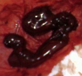 正常月经照片,月经照片背后的秘密解析